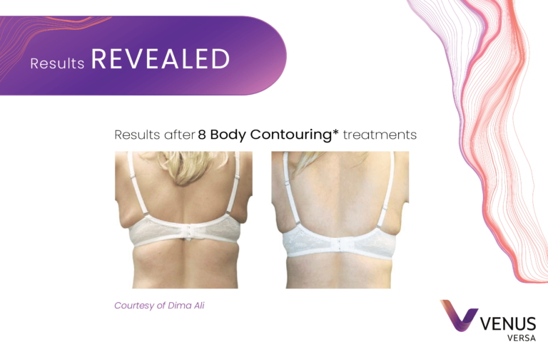 Body Contouring