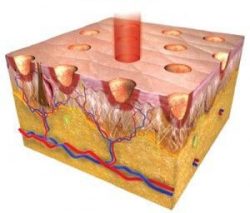 Image showing how fractionated means the laser pokes holes into the skin rather than removing all the skin with Lumenis Accupulse CO2 Laser.